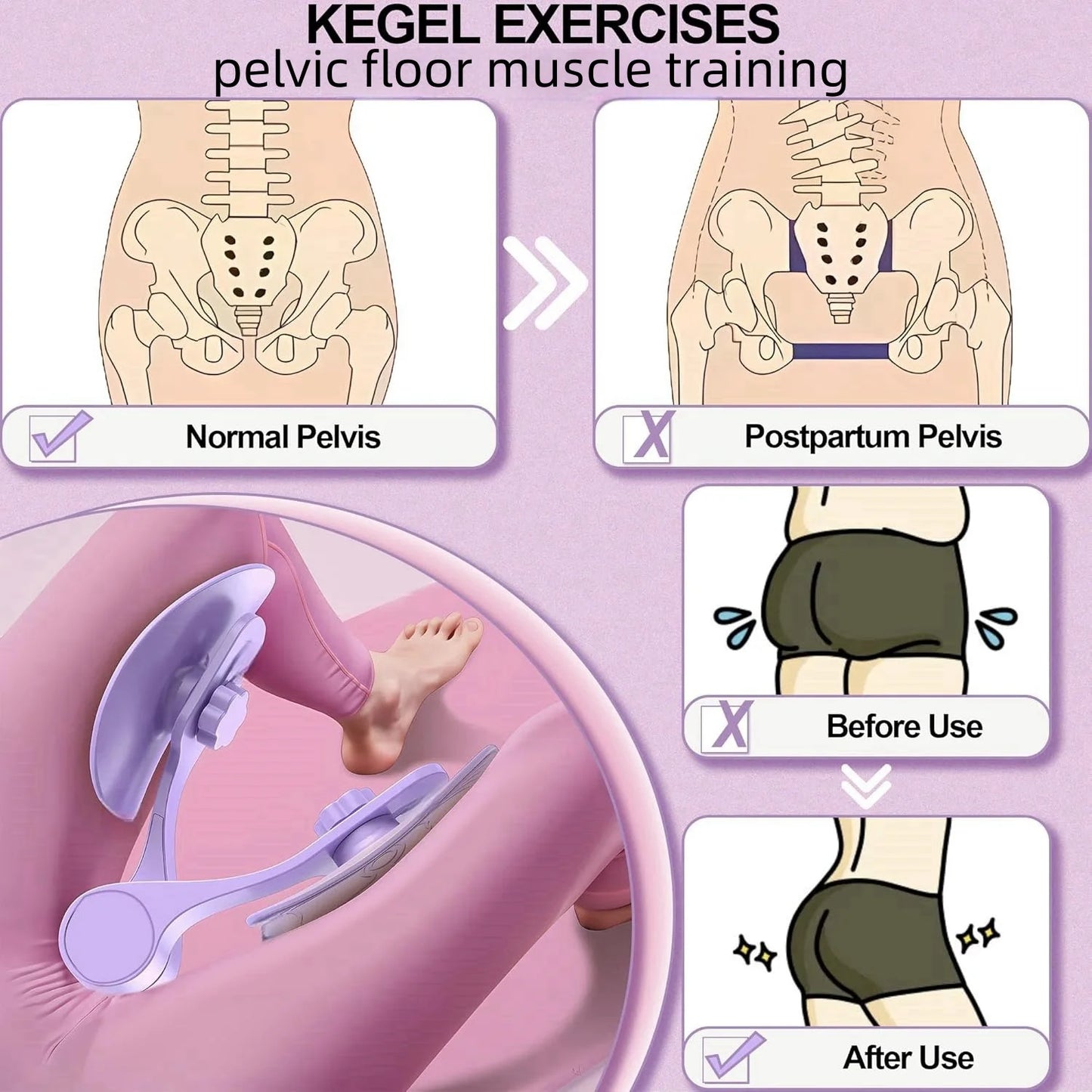 Kegel Pelvic Floor Muscle Trainer