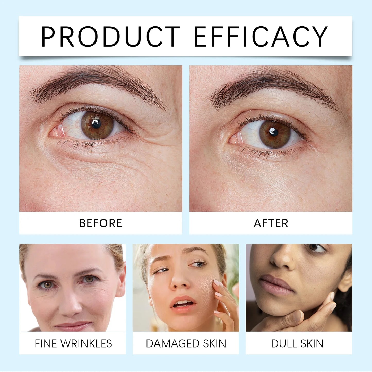 Neck Wrinkle Protein Cream