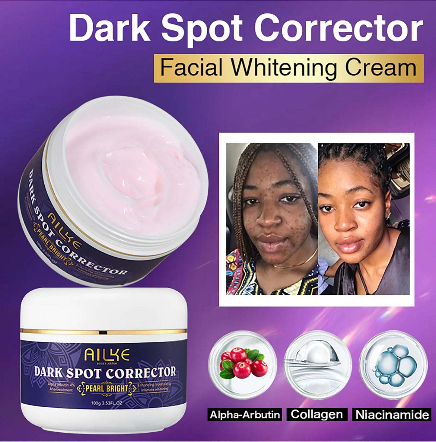 Dark Spots Remover Cream