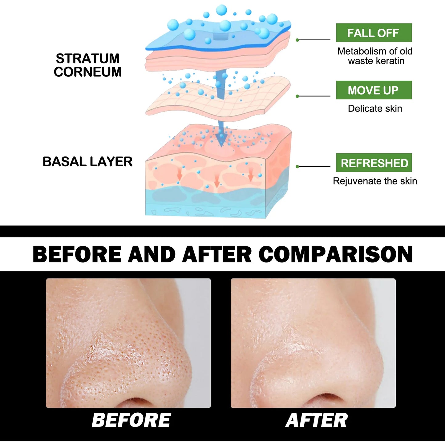 Charcoal Face Strips and Oil Set